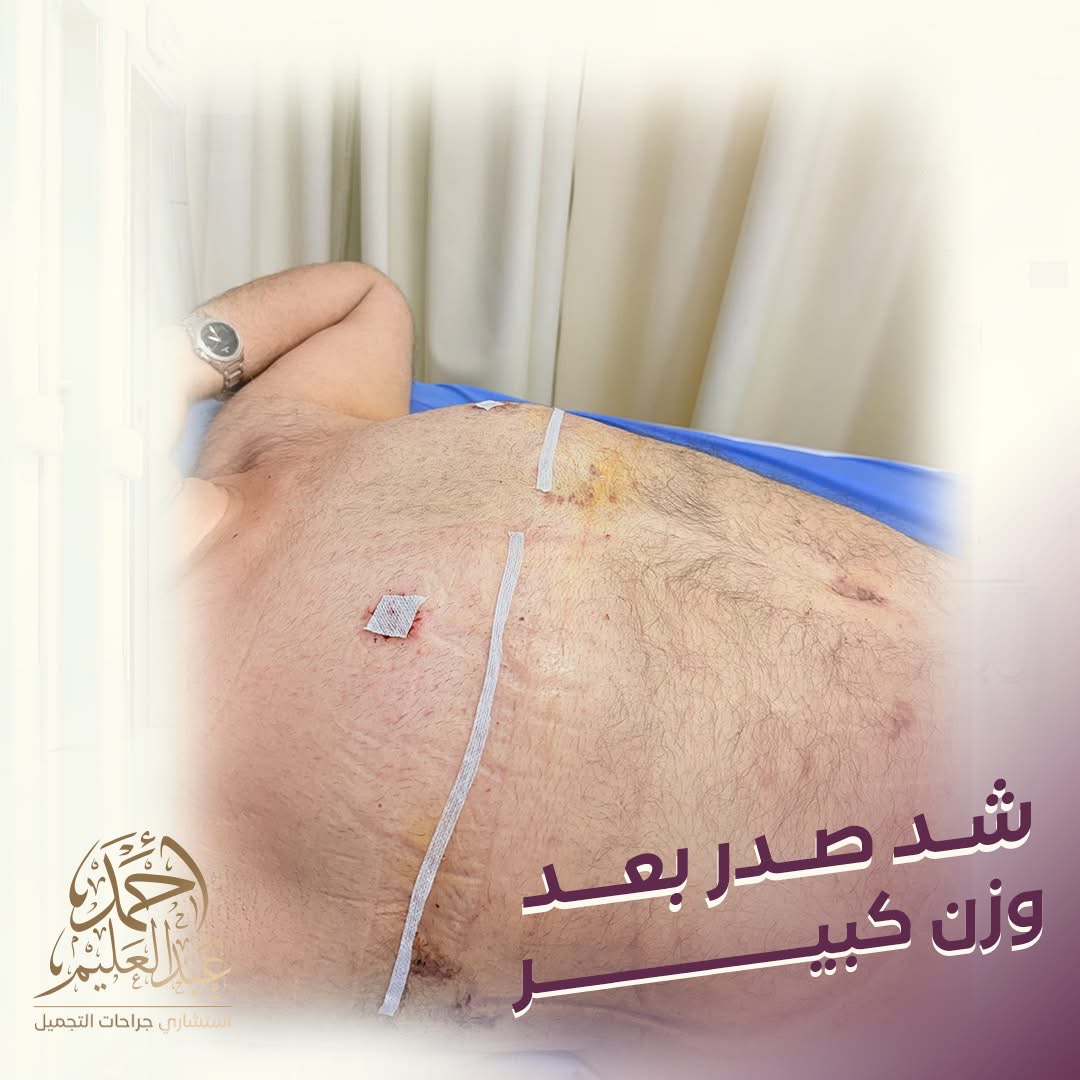 بعد شد صدر بعد وزن كبير